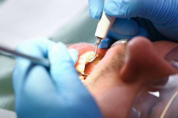 Best Weekend Emergency Dentist in Black Earth, WI