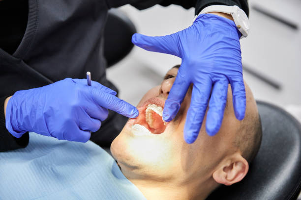 Best Emergency Dental Care for Broken or Chipped Teeth in Black Earth, WI