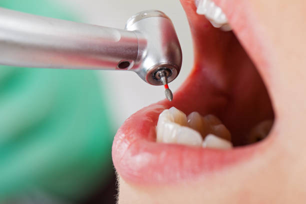 Best Emergency Dental Care for Broken or Chipped Teeth in Black Earth, WI